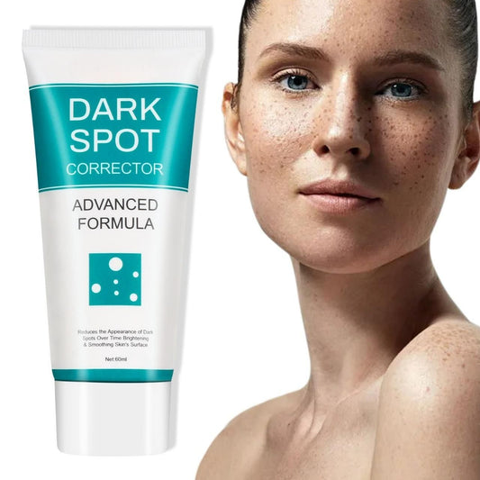 ✨ Dark Spot Corrector for Face (60 ml) – Radiant & Even Skin Tone 🌿